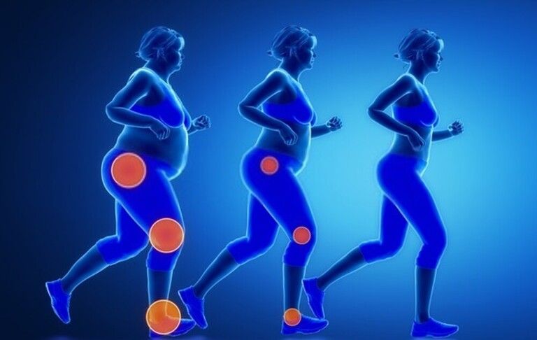 How Should An Obese Person Start Exercising? How Should An Obese Person Start Exercising?